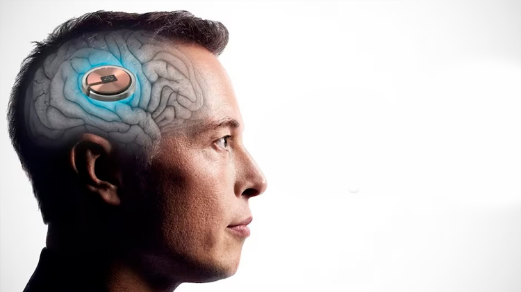 Elon Musk recebe aval para iniciar testes de chip cerebral em humanos