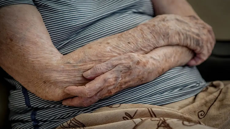 SUS terá primeiro medicamento para demência associada ao Parkinson